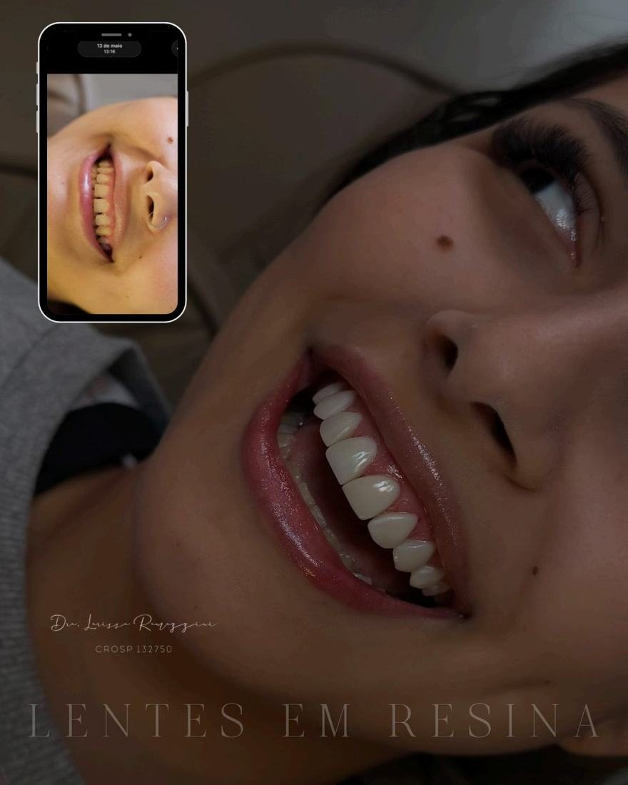 Procedimentos dentários