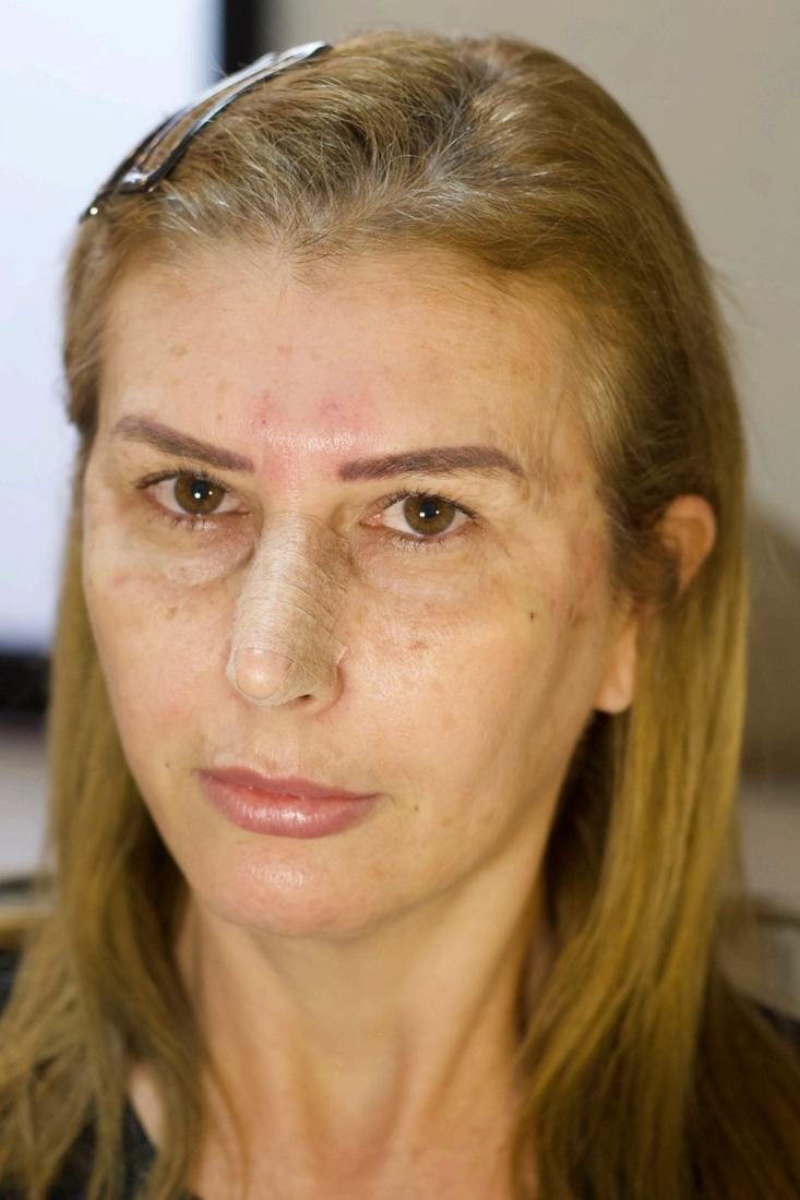 Procedimentos faciais